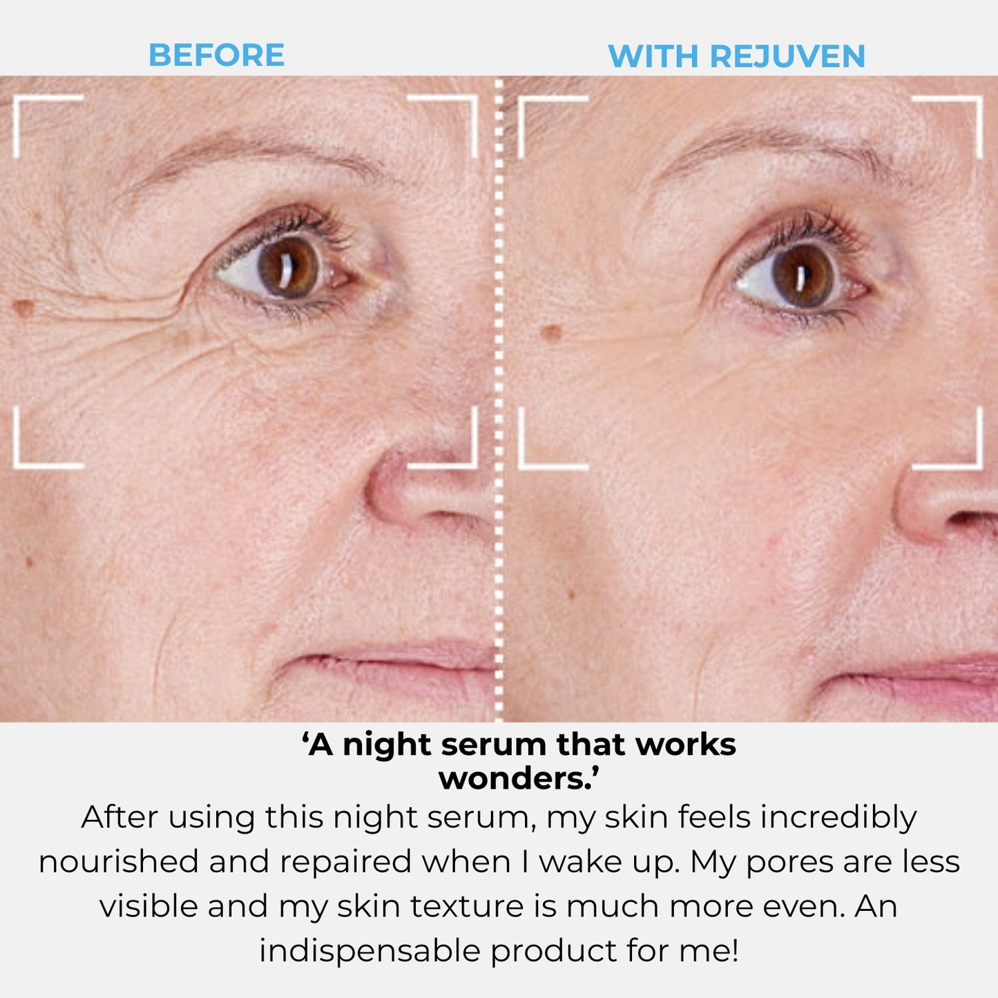 Rejuven Subscription