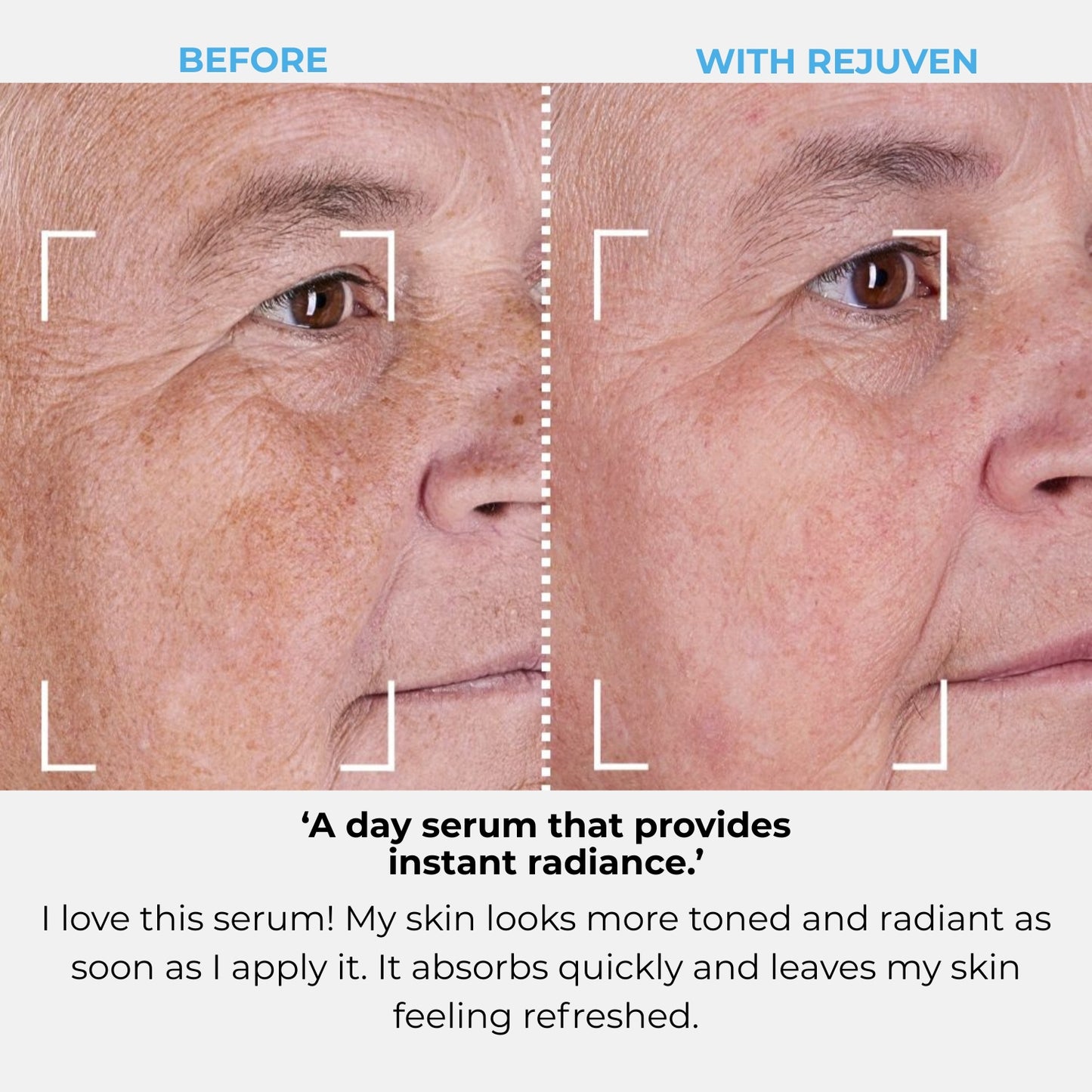 Rejuven Subscription