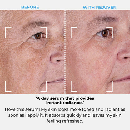 Rejuven Subscription
