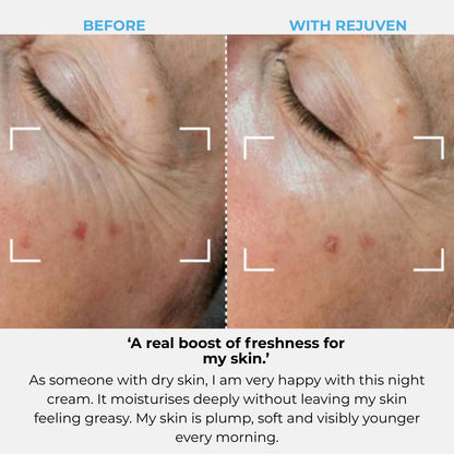 Rejuven Subscription